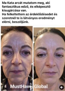 Referencia kép